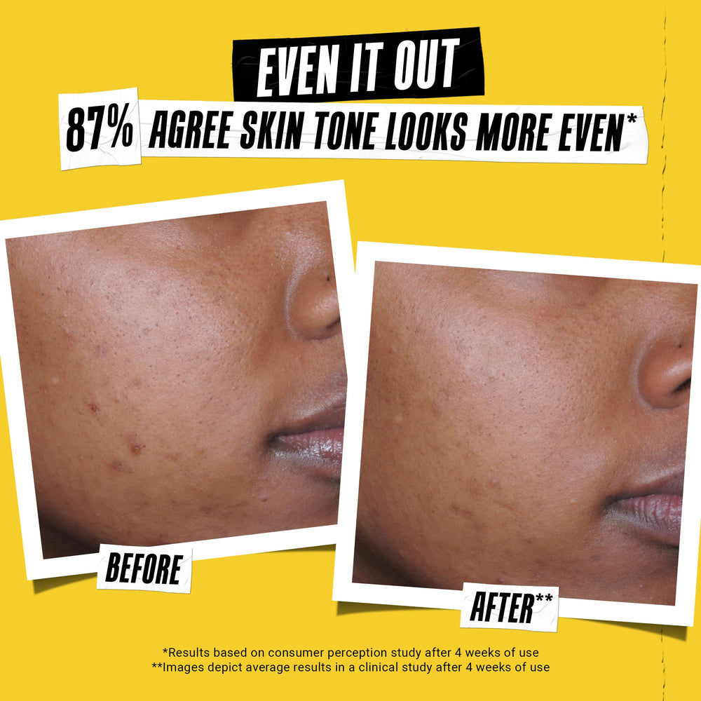 Kiehl's Better Screen lightweight texture indicates quick absorption.