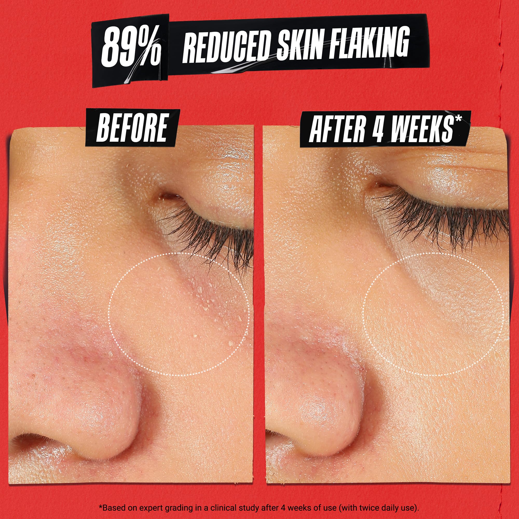 Product label of Kiehl's Ultra Facial Recovery Barrier Cream emphasizing sensitive skin benefit