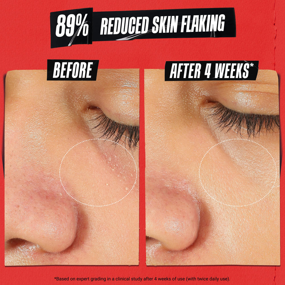 Product label of Kiehl's Ultra Facial Recovery Barrier Cream emphasizing sensitive skin benefit