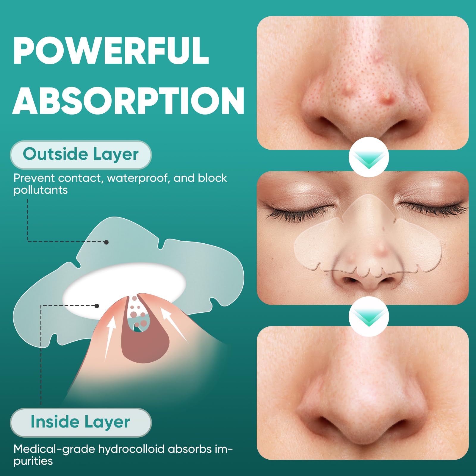 Kindshine nose pore patches turning white after absorption, indicating activity.