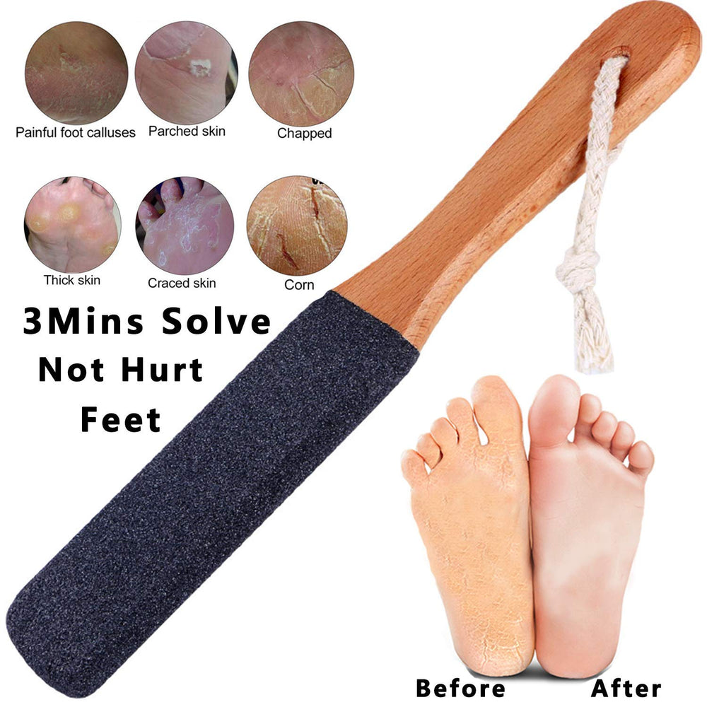 Kinepi foot file with natural corundum stone for exfoliating thick skin