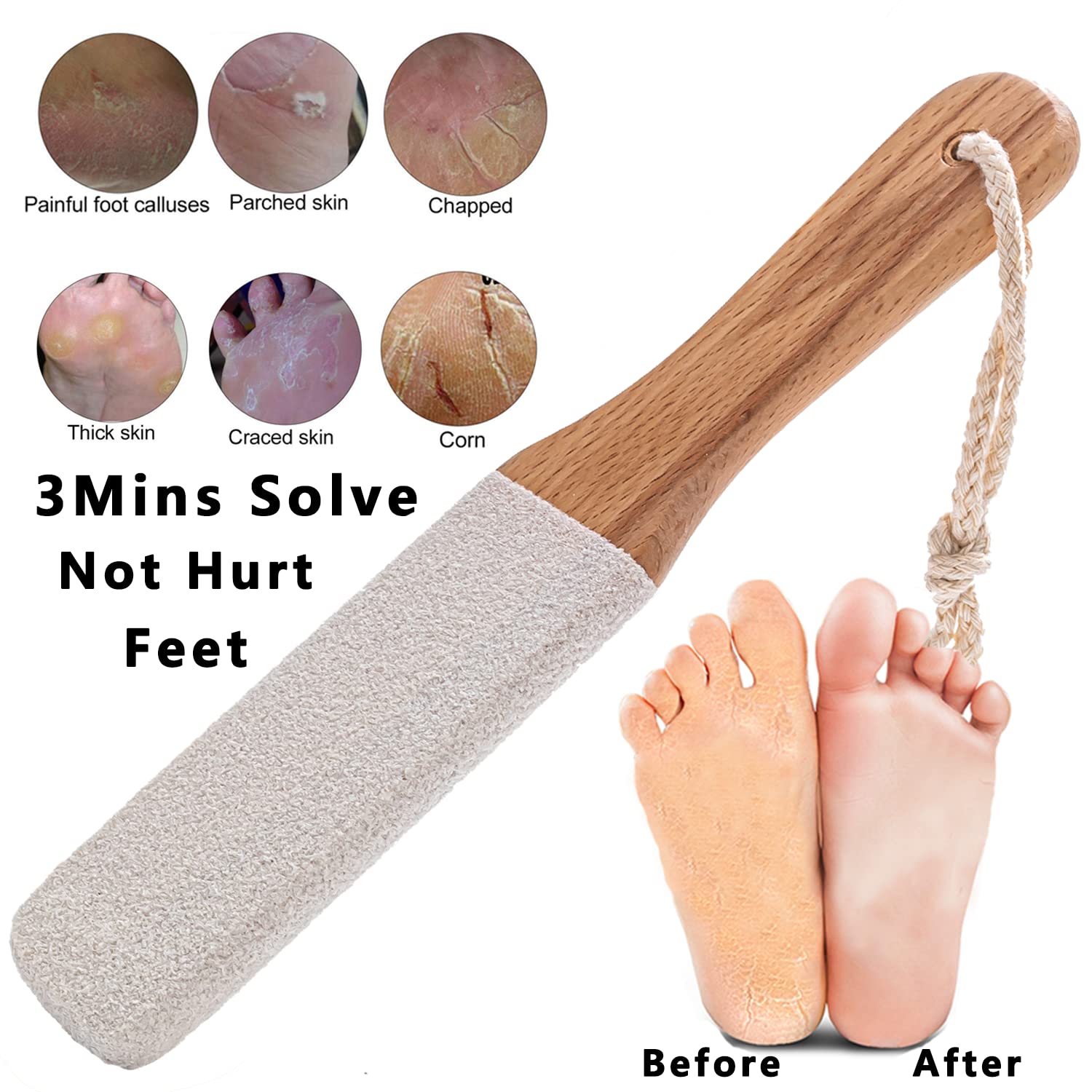 Kinepi white corundum stone surface removes dead skin efficiently