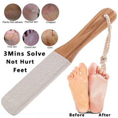 Kinepi white corundum stone surface removes dead skin efficiently