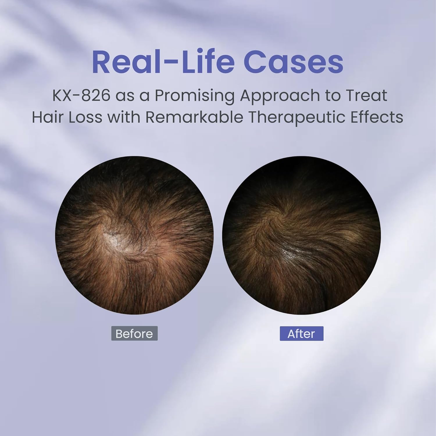 KINTOR oil-control action targets excess sebum for a refreshed look.