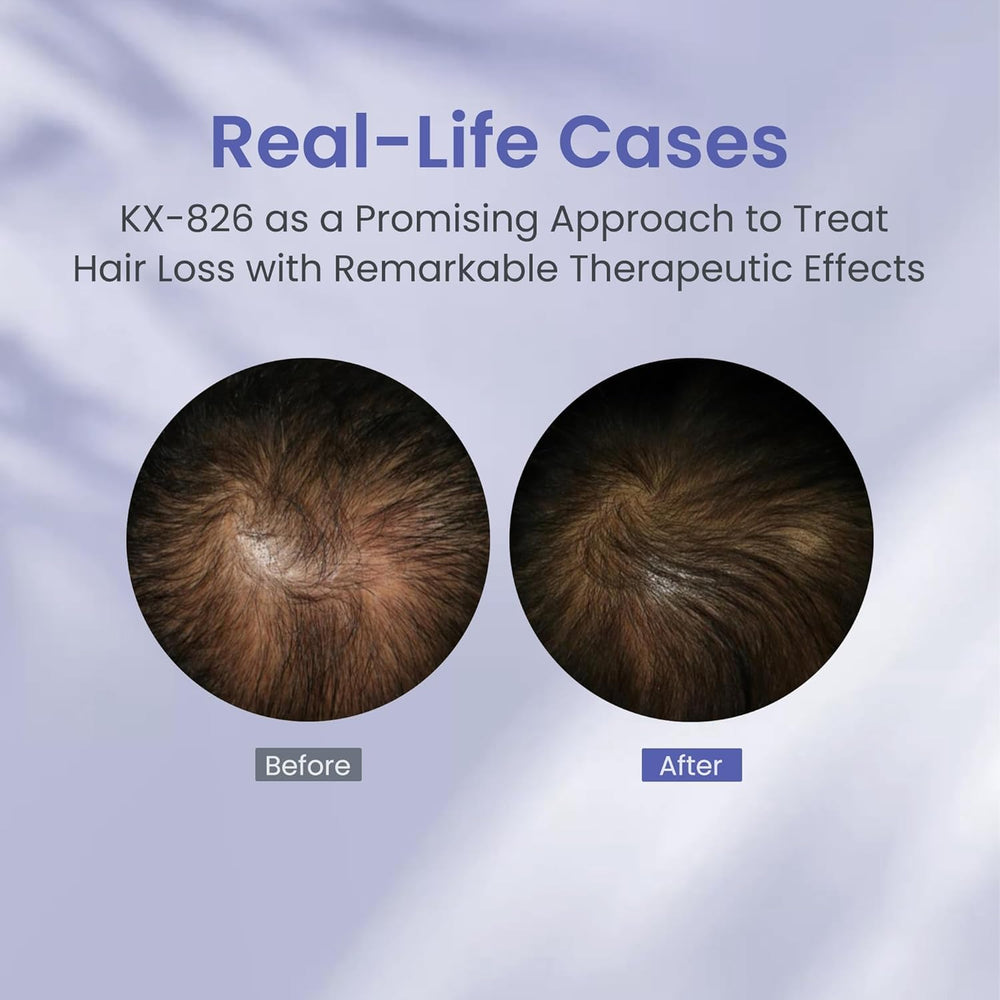 KINTOR oil-control action targets excess sebum for a refreshed look.