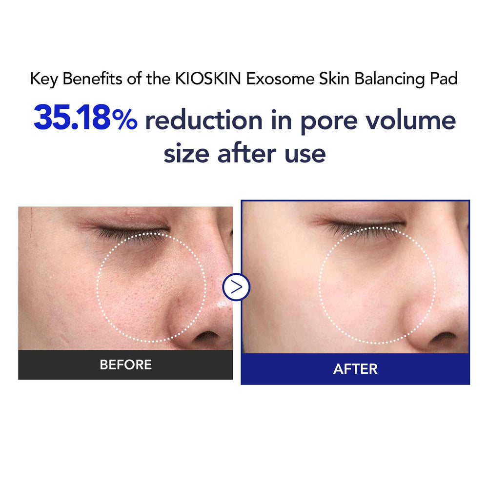 Kioskkin Brightening glow appears after routine to enhance radiance.