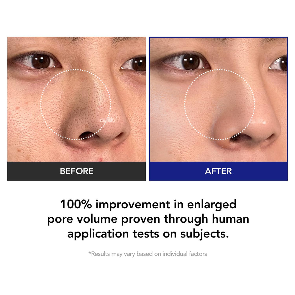 Kioskkin Triple-Acid Exfoliation blends AHA, BHA, and PHA for refined texture.