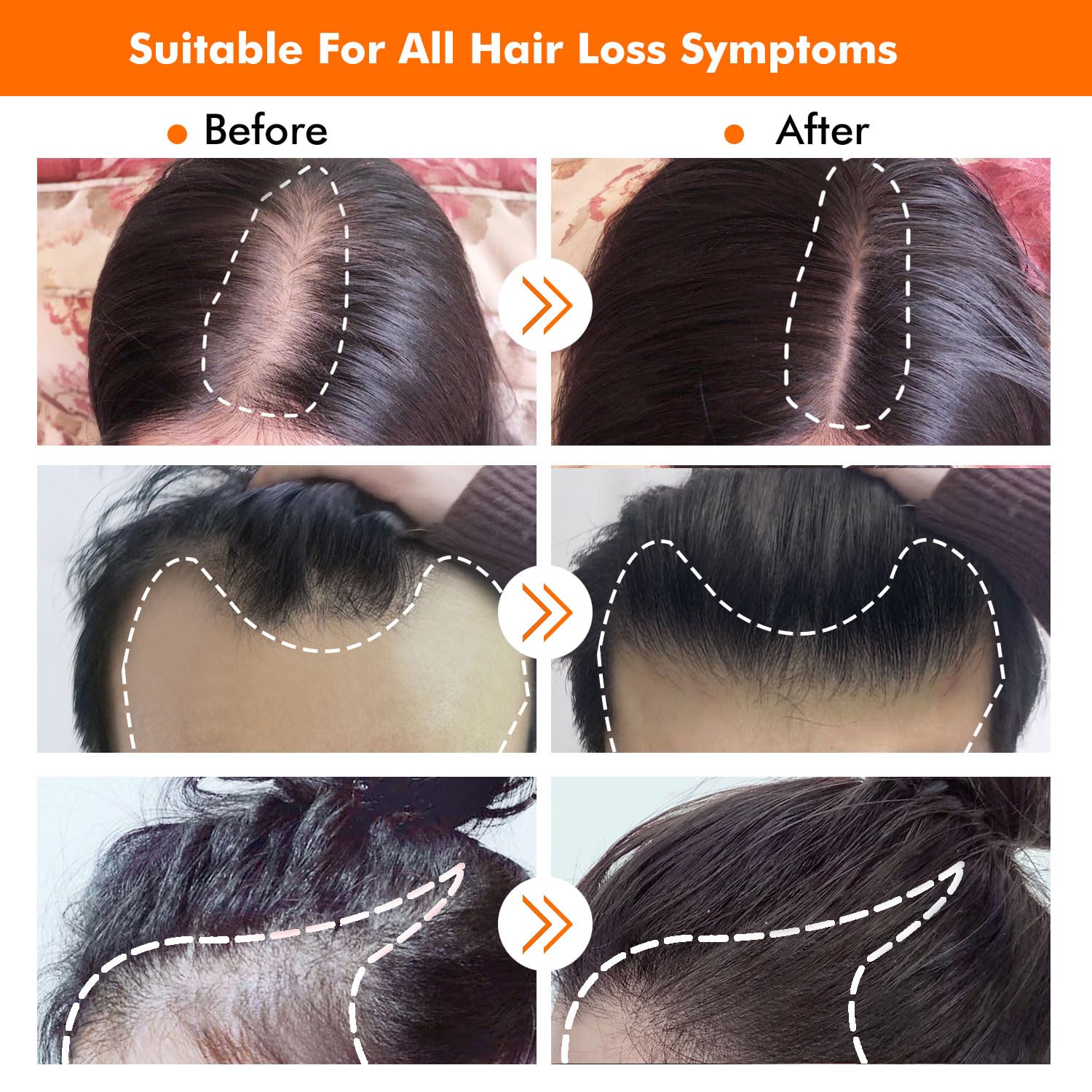KIRUBRET Applying serum to the scalp supports better absorption.