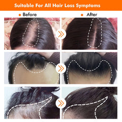 KIRUBRET Applying serum to the scalp supports better absorption.