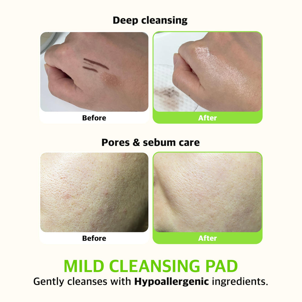 KLAVUU Phytoncide Quick Cleansing Pad deep pore cleansing for clearer-looking pores