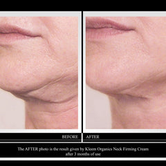 Kleem Organics retinol moisturizer texture closeup highlighting smooth application.
