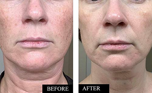 Dropper releasing serum for precise application and even distribution.