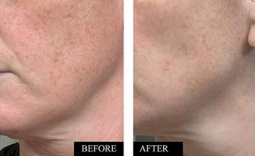 Serum applied to clean facial skin showing quick absorption.