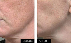 Serum applied to clean facial skin showing quick absorption.