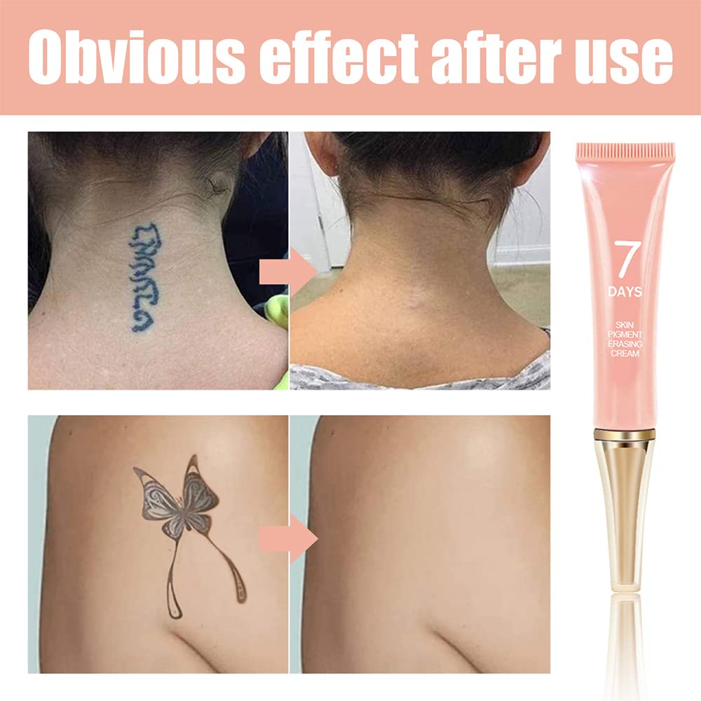 Klsychry Tattoo Removal Cream being applied to tattooed skin for even coverage.