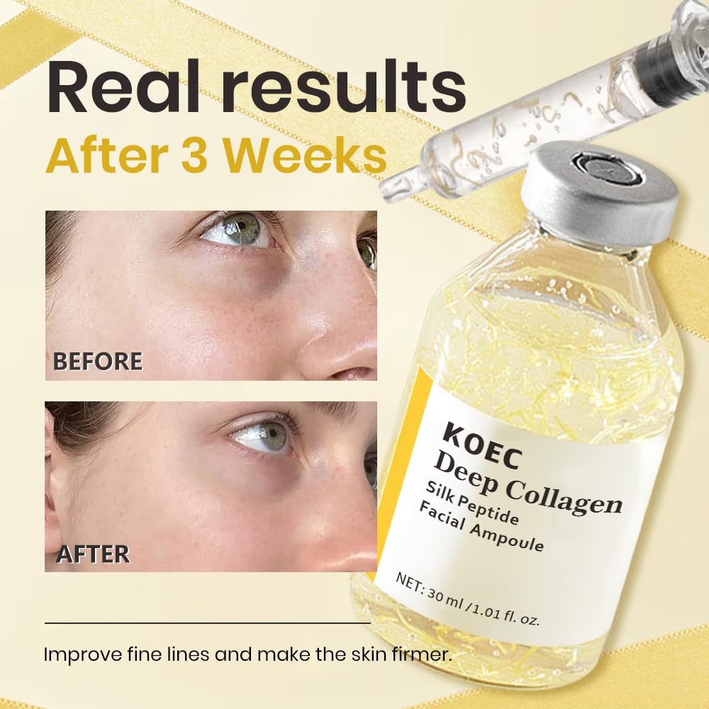 KOEC eye area tightening application demonstrates contour improvement potential