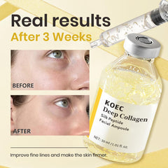KOEC eye area tightening application demonstrates contour improvement potential