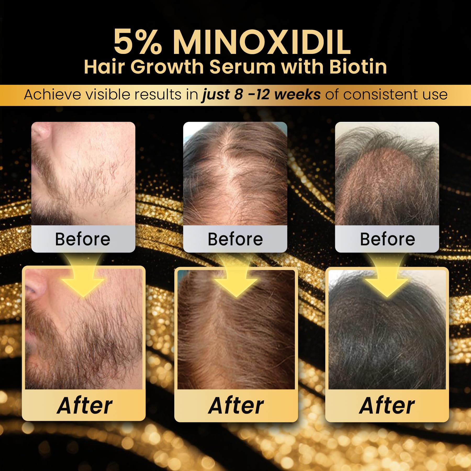 Koi Beauty beard growth application on facial hair for fuller look.