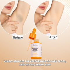 Kojic Underarm Brightening Serum dispensing drops showing precise usage