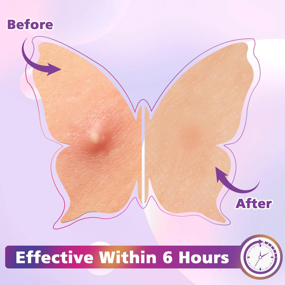 KONEUK butterfly-shaped patches on skin add playful styling to care routine