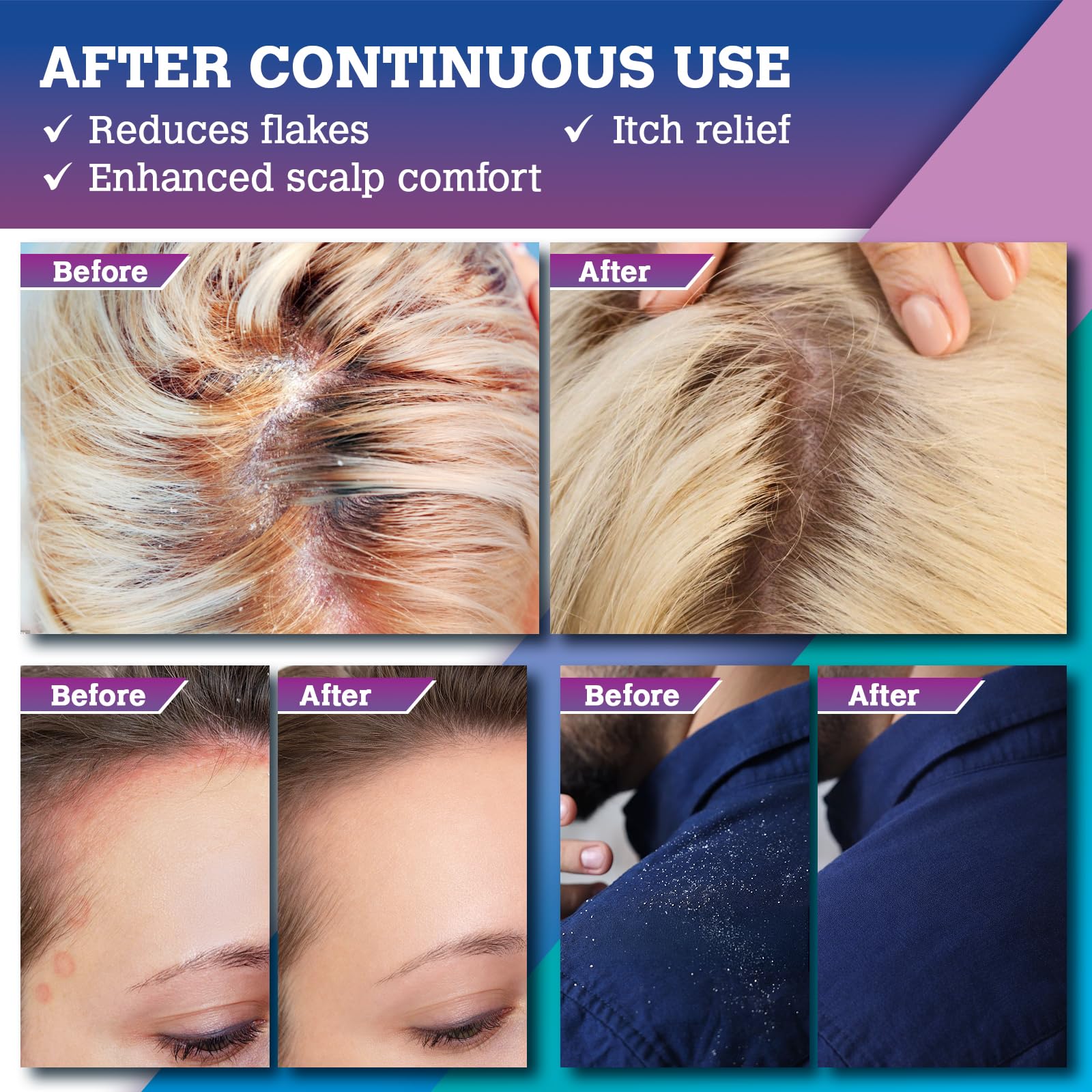 Kopa Haiku scalp balance portrait suggests comfortable, itch-free everyday use.