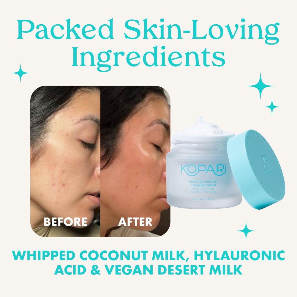 Kopari Moisture Whipped Ceramide Cream jar close-up highlights creamy hydration.