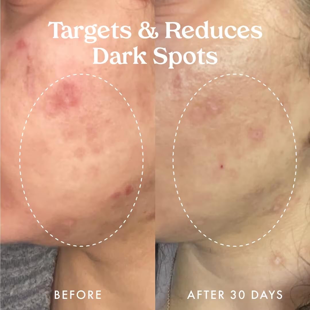 Kopari Star Bright Serum Kakadu Plum ingredient symbol suggesting natural brightening.