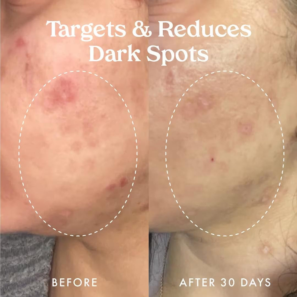 Kopari Star Bright Serum Kakadu Plum ingredient symbol suggesting natural brightening.