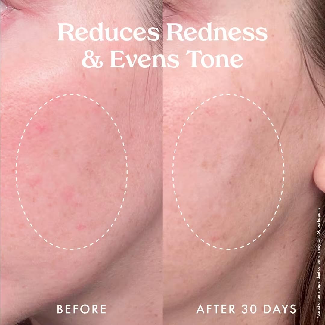 Kopari Star Bright Serum Niacinamide bottle emphasizing refined pores and smooth skin.