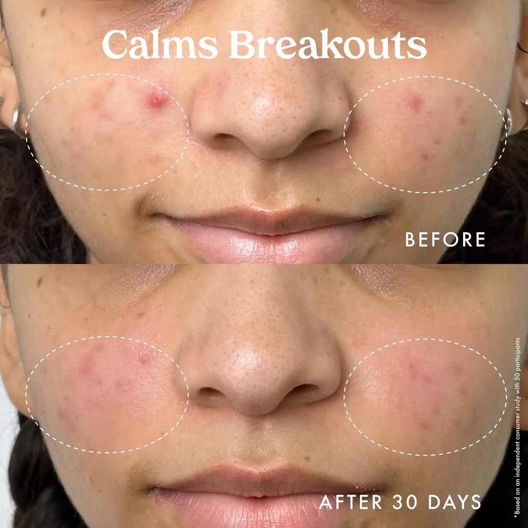 Kopari Star Bright niacinamide bottle supporting calm and even tone.
