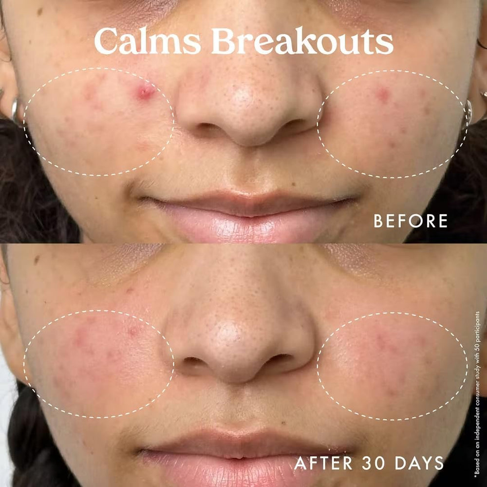 Kopari Star Bright niacinamide bottle supporting calm and even tone.