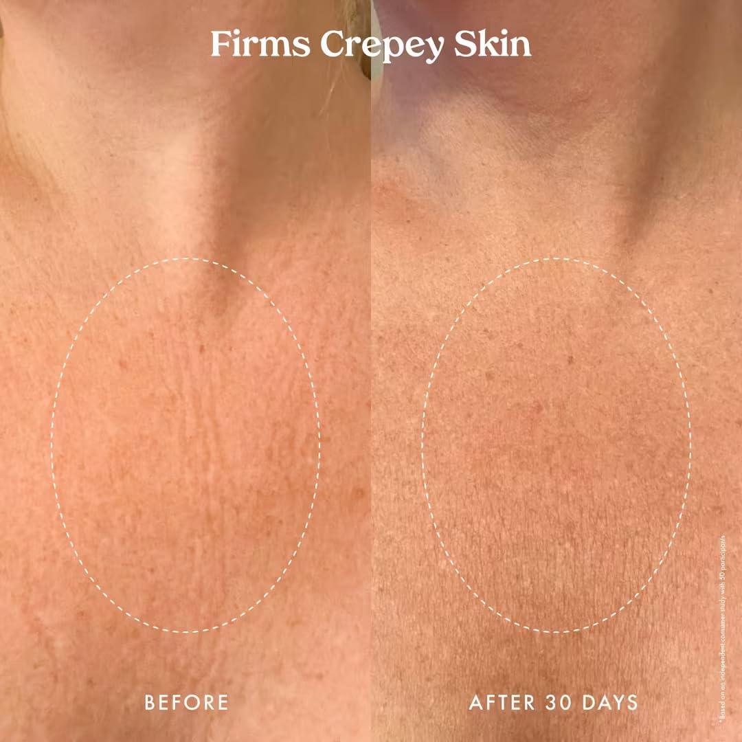 Kopari Ultra Renewal Retinol Body Cream on legs highlighting skin smoothing.