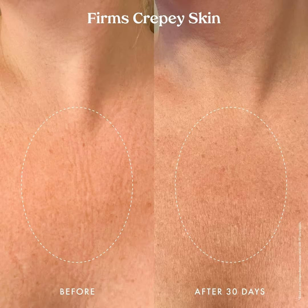 Kopari Ultra Renewal Retinol Body Cream on legs highlighting skin smoothing.