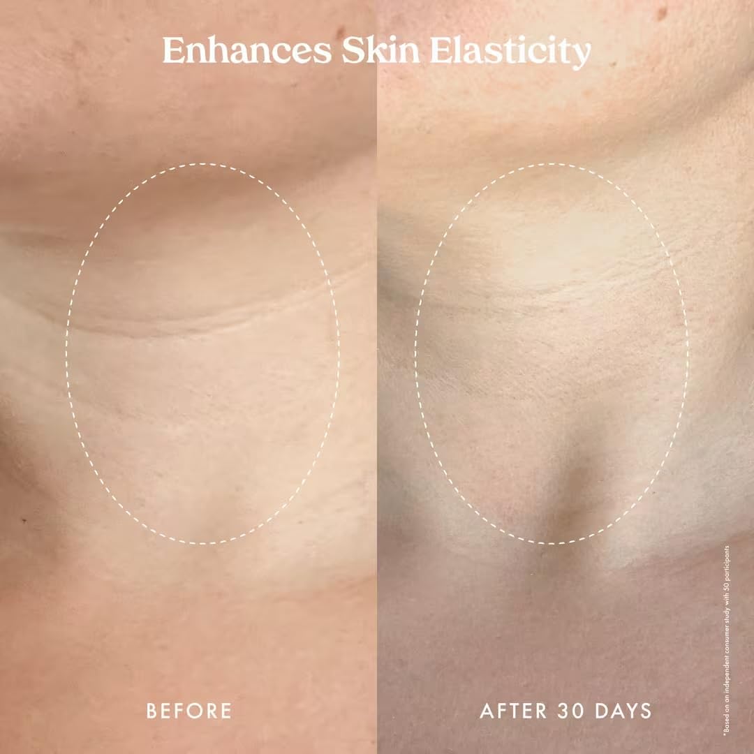 Kopari Ultra Restore Serum hydration glow suggests potential for smoother tone.