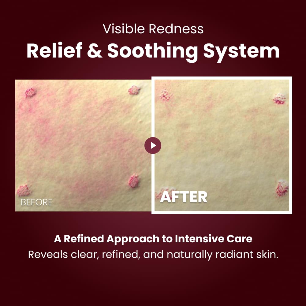 Kopher Niacinamide botanical care focus on calming stressed skin.