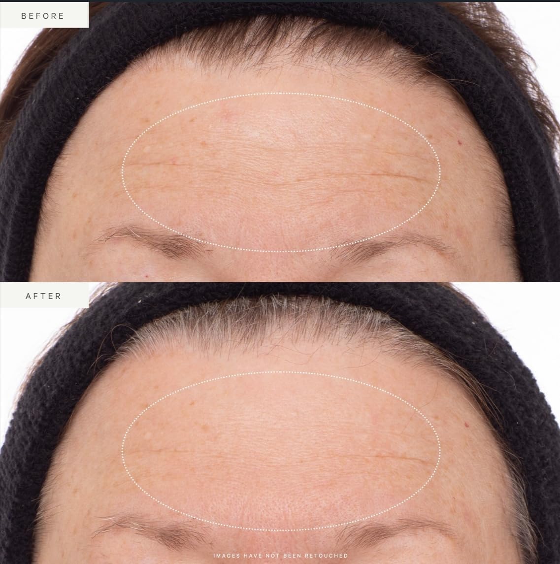 Acai stem cells, Noni fruit, and Rosehip Oil nourish the skin in the formula.
