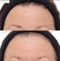 Acai stem cells, Noni fruit, and Rosehip Oil nourish the skin in the formula.