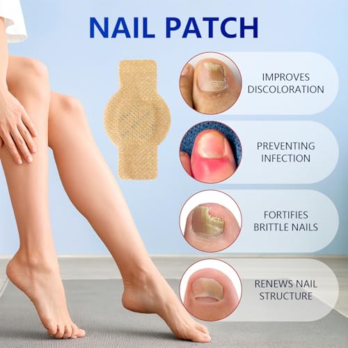 Kosimi Nail Patches Brittle Nails: strengthens appearance with patch coverage