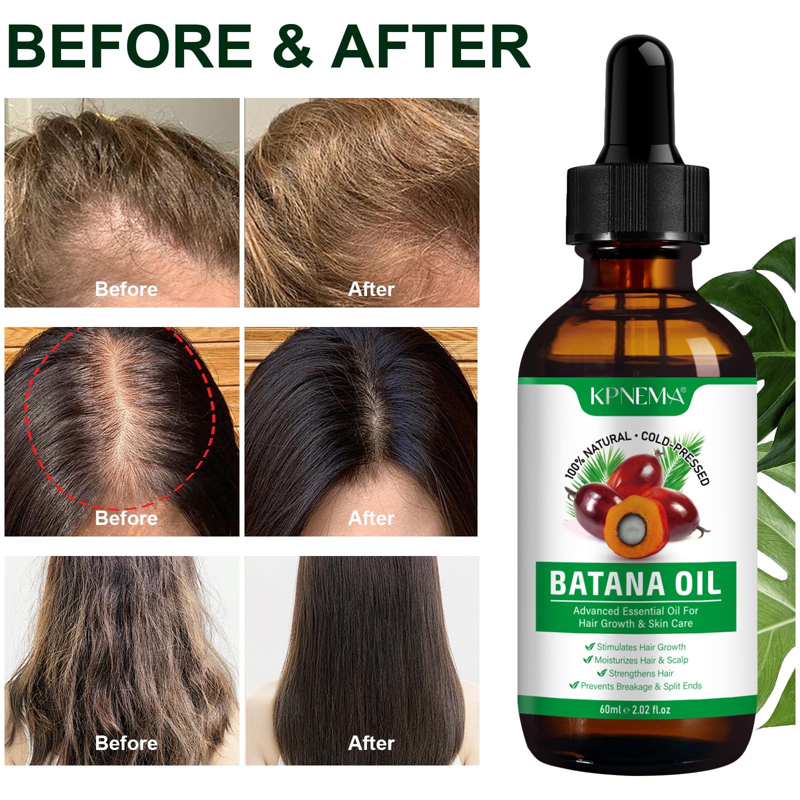 KPNEMA Batana Oil delivers deep hydration for dry, rough skin areas.