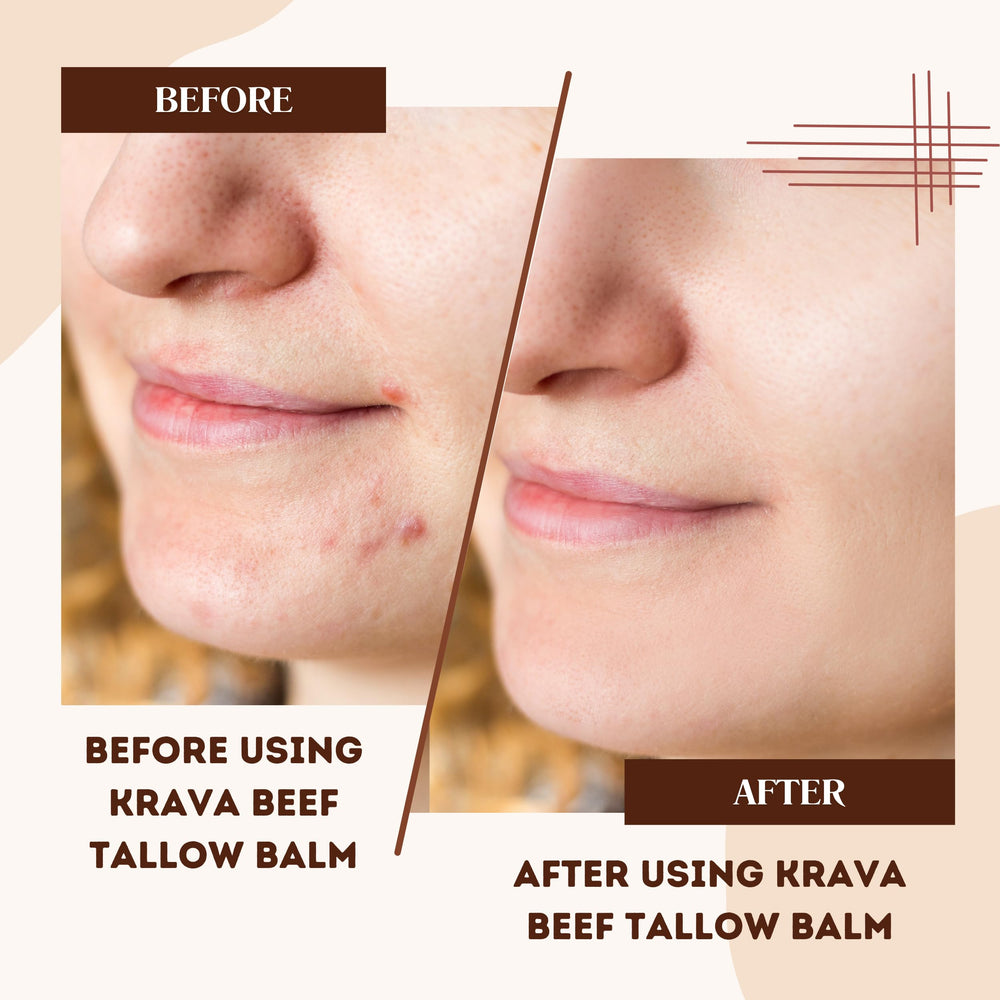 Krava Naturals beef tallow face jar offers gentle moisture for daily complexion care.