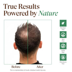 Kreyol Essence Aloe Vera gel on scalp indicating soothing relief.