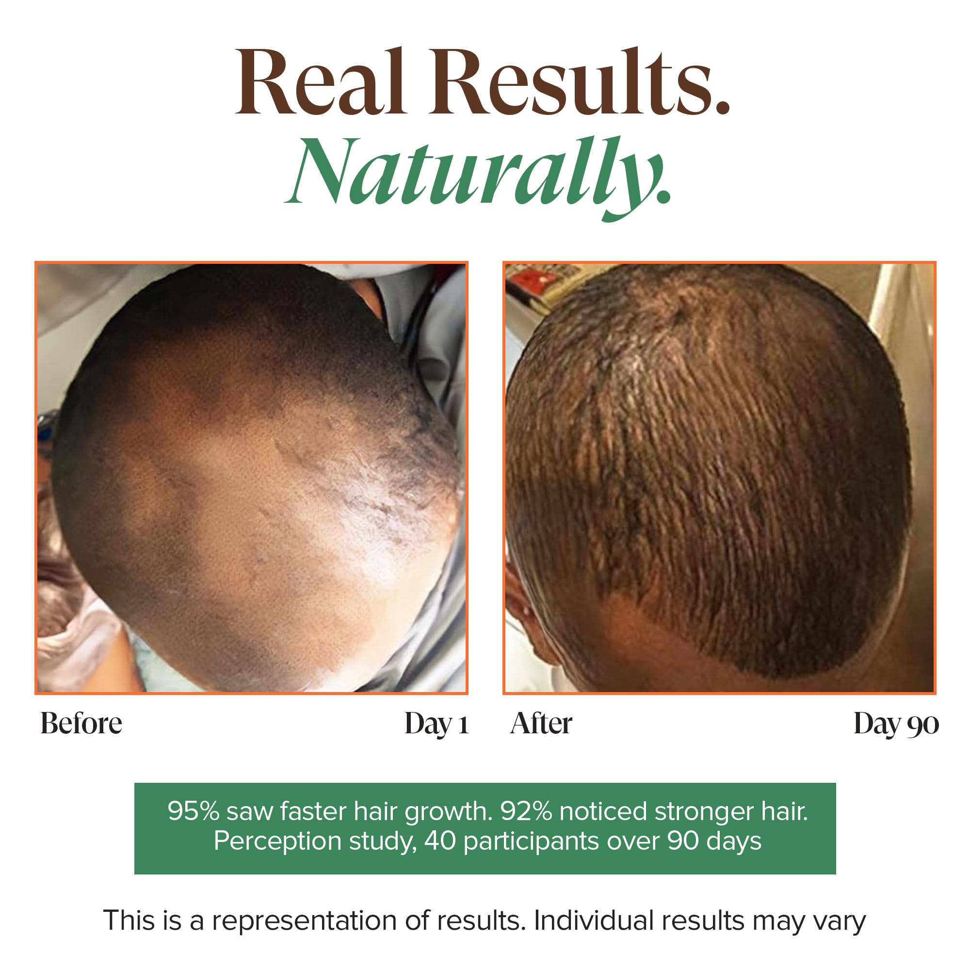 Scalp application image showing massage technique for scalp and brows.
