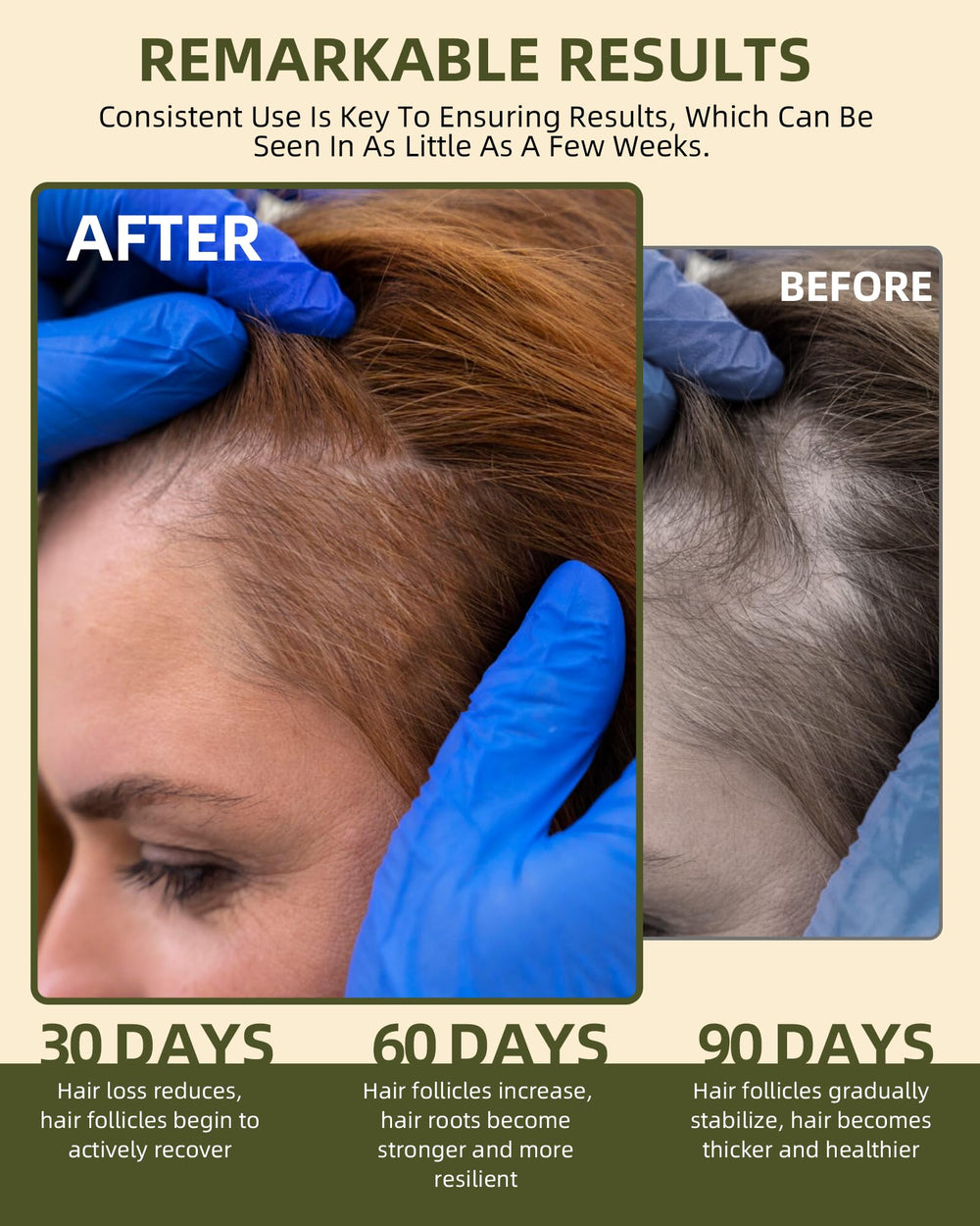 Ktintar Batana oil drops for targeted scalp nourishment