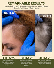 Ktintar Batana oil drops for targeted scalp nourishment