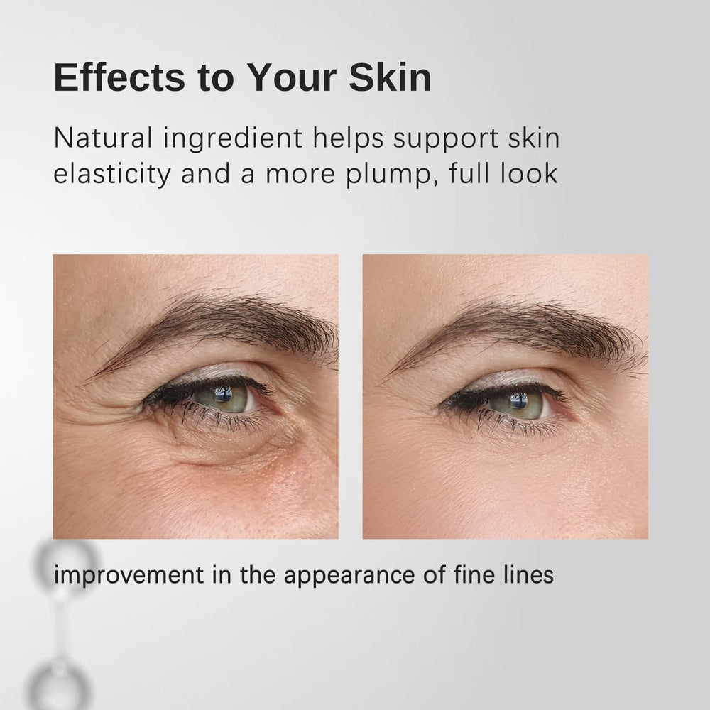 KunMan Deep Collagen Cream-Serum wrinkle lines close-up suggesting smoothing effect
