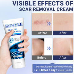 Kunyle Scar Cream application massage shows smooth spreading
