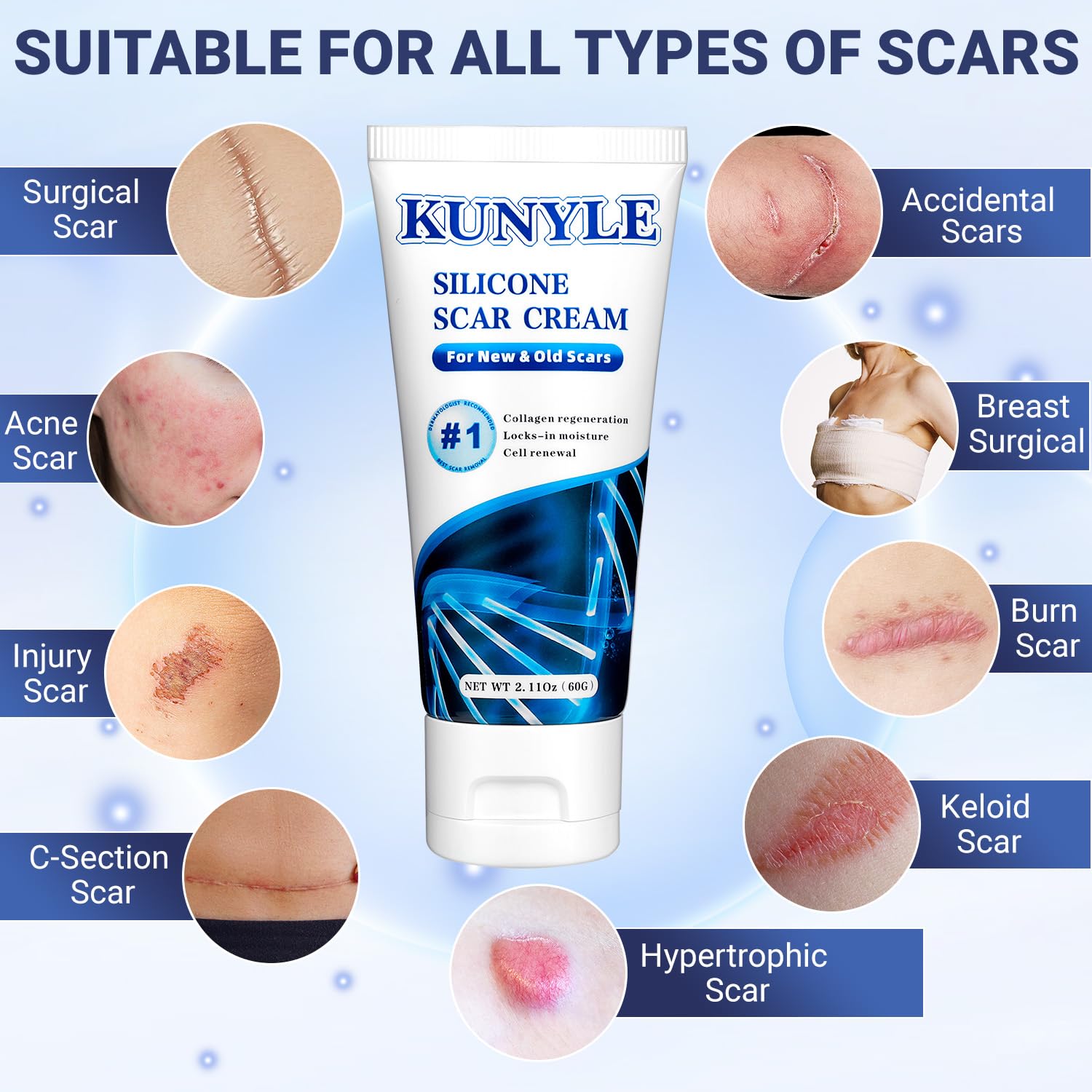 Kunyle Scar Cream lightweight texture on skin