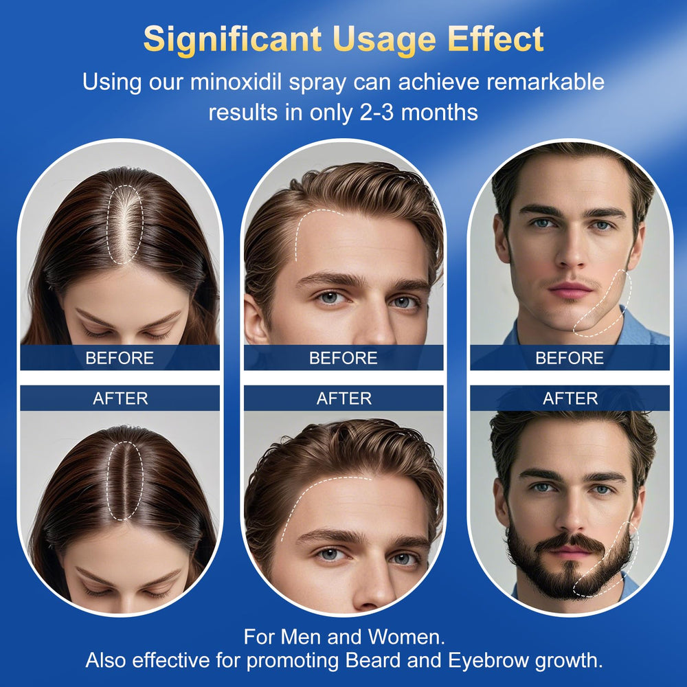 Kweqdsd thicker fuller hair result visualization hints at results.