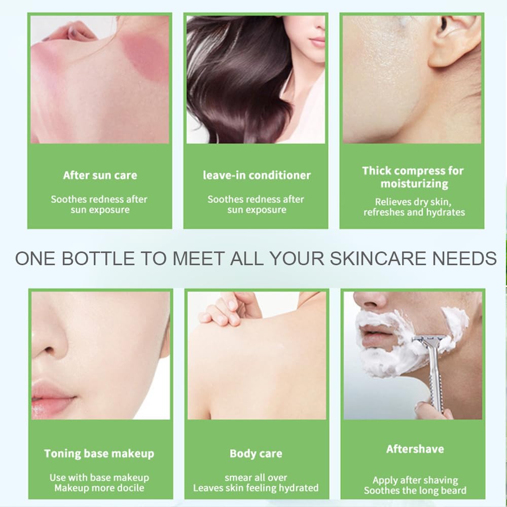 KYAALN Aloe Gel cools sun-exposed skin while hydrating