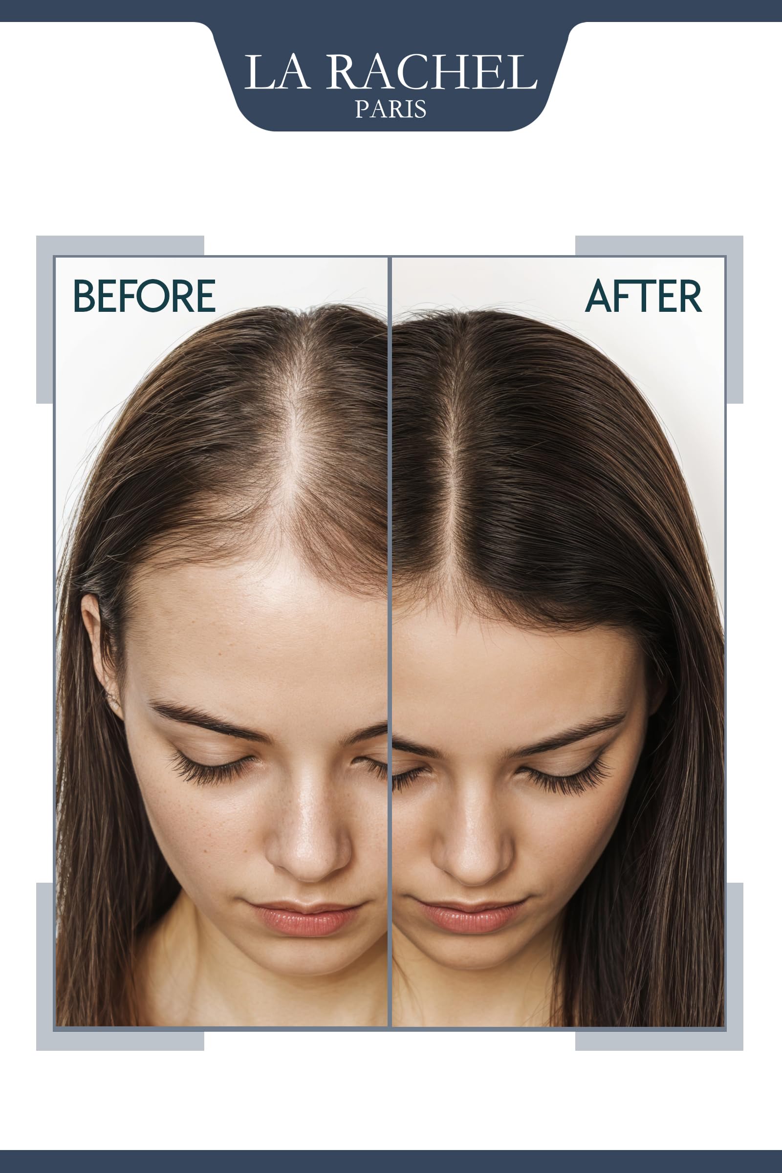 La Rachel anti-hair loss tonic label closeup communicates Biotin and Panthenol benefits.